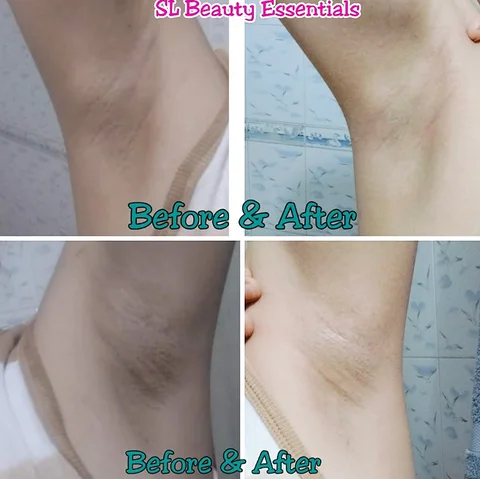 Underarms whitening Cream