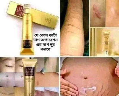 Bd.TCM scar removal cream Original