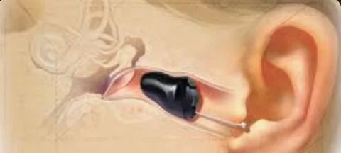 Hearing Aid Machine